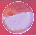 Parche doble aceite 14" StarSMaker® SM-PCA14T 